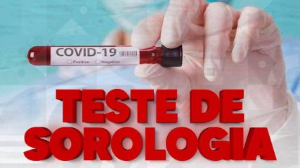 Teste Sorologia
