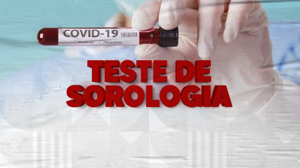 sorologia site